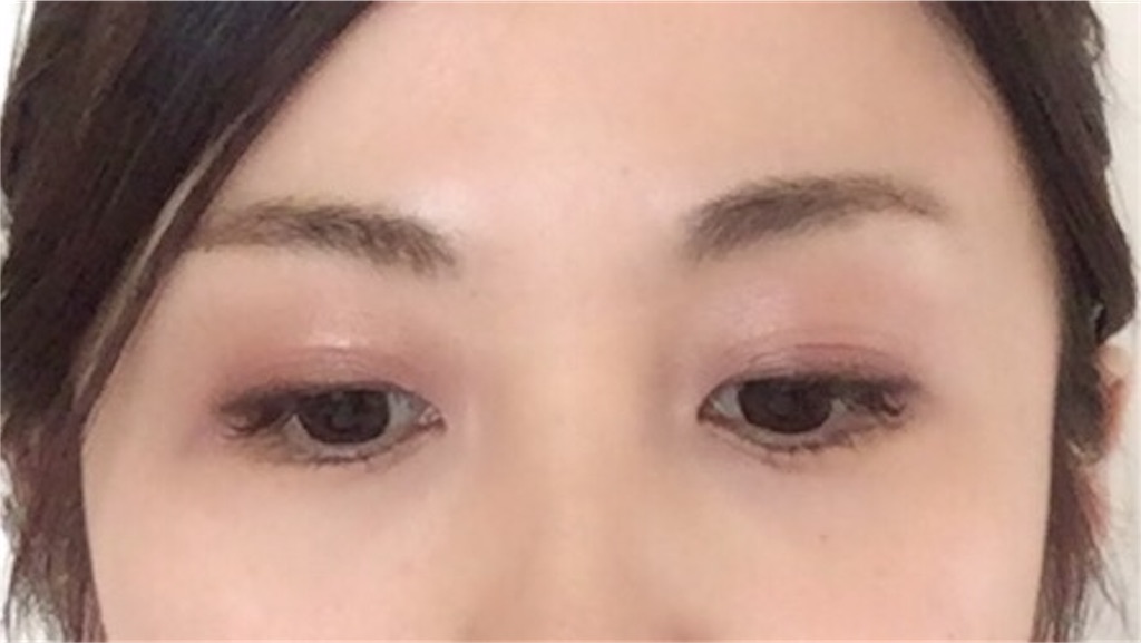 f:id:yurikablog:20171011131049j:plain