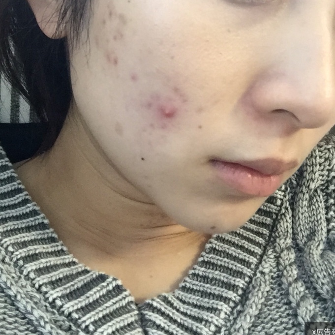 f:id:yurikablog:20181022163055j:plain