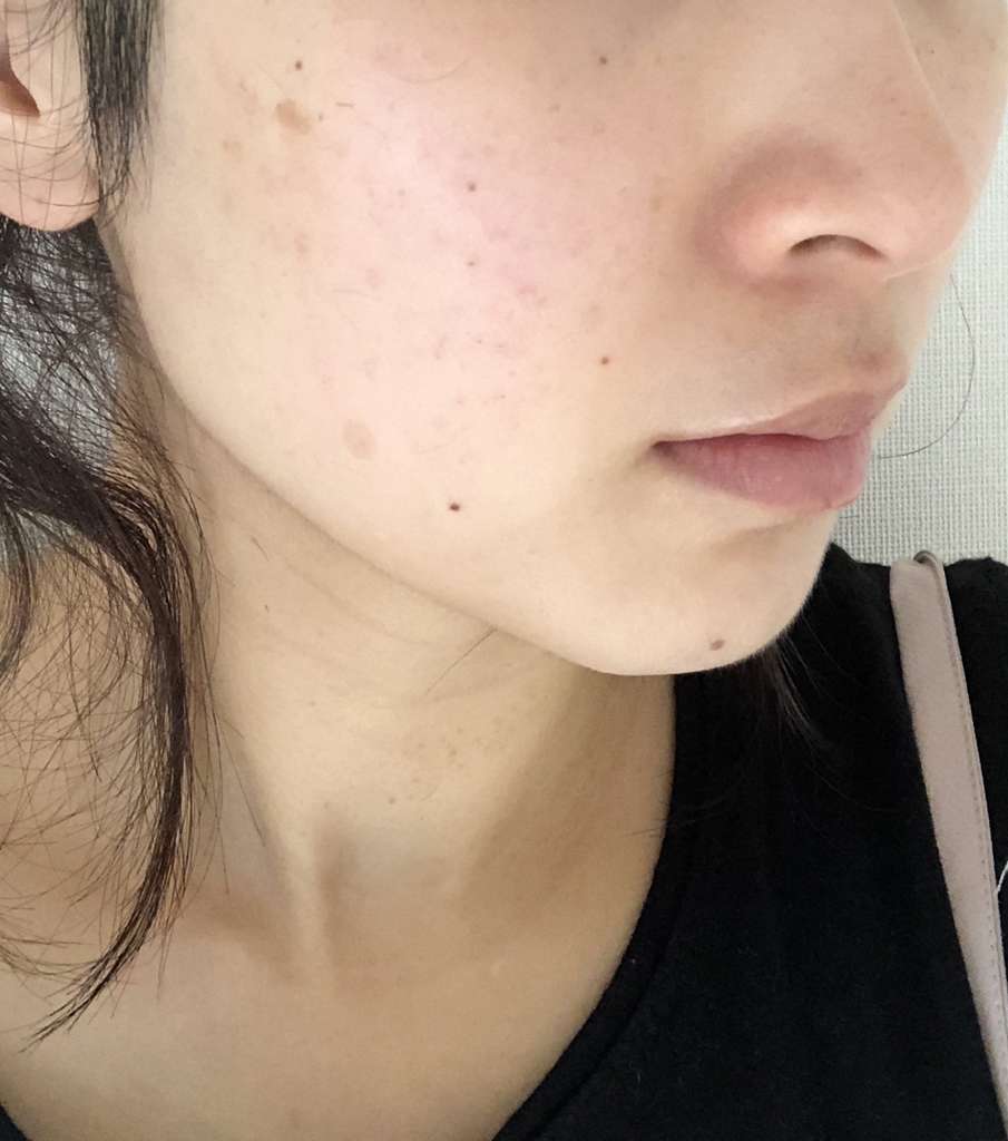 f:id:yurikablog:20181022174725j:plain f:id:yurikablog:20181022174725j:plain