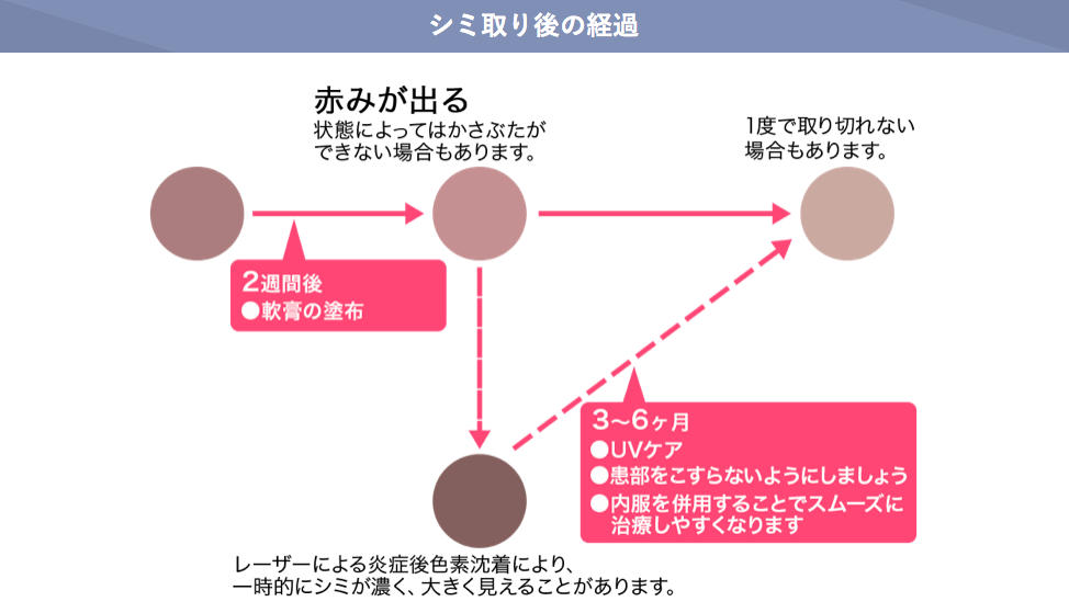 f:id:yurikablog:20220312163537p:plain